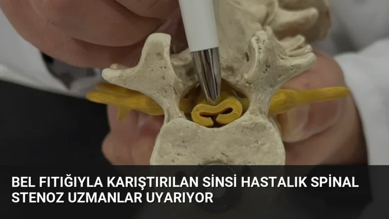 Bel Fıtığıyla Karıştırılan Sinsi Hastalık Spinal Stenoz Uzmanlar Uyarıyor
