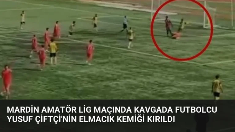 Mardin Amatör Lig Maçında Kavgada Futbolcu Yusuf Çiftçi’nin Elmacık Kemiği Kırıldı