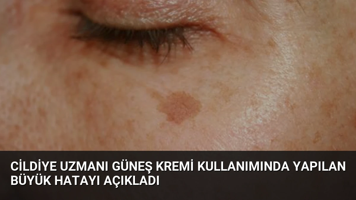 Cildiye Uzmanı Güneş Kremi Kullanımında Yapılan Büyük Hatayı Açıkladı