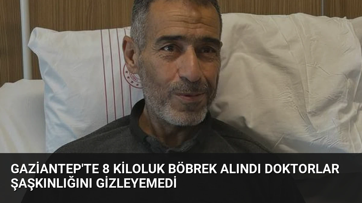 Gaziantep’te 8 Kiloluk Böbrek Alındı Doktorlar Şaşkınlığını Gizleyemedi