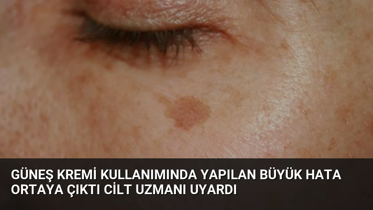 Güneş Kremi Kullanımında Yapılan Büyük Hata Ortaya Çıktı Cilt Uzmanı Uyardı