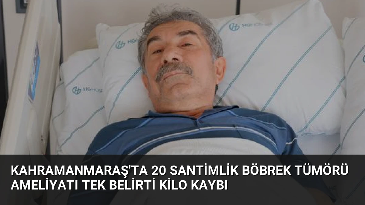 Kahramanmaraş’ta 20 Santimlik Böbrek Tümörü Ameliyatı Tek Belirti Kilo Kaybı