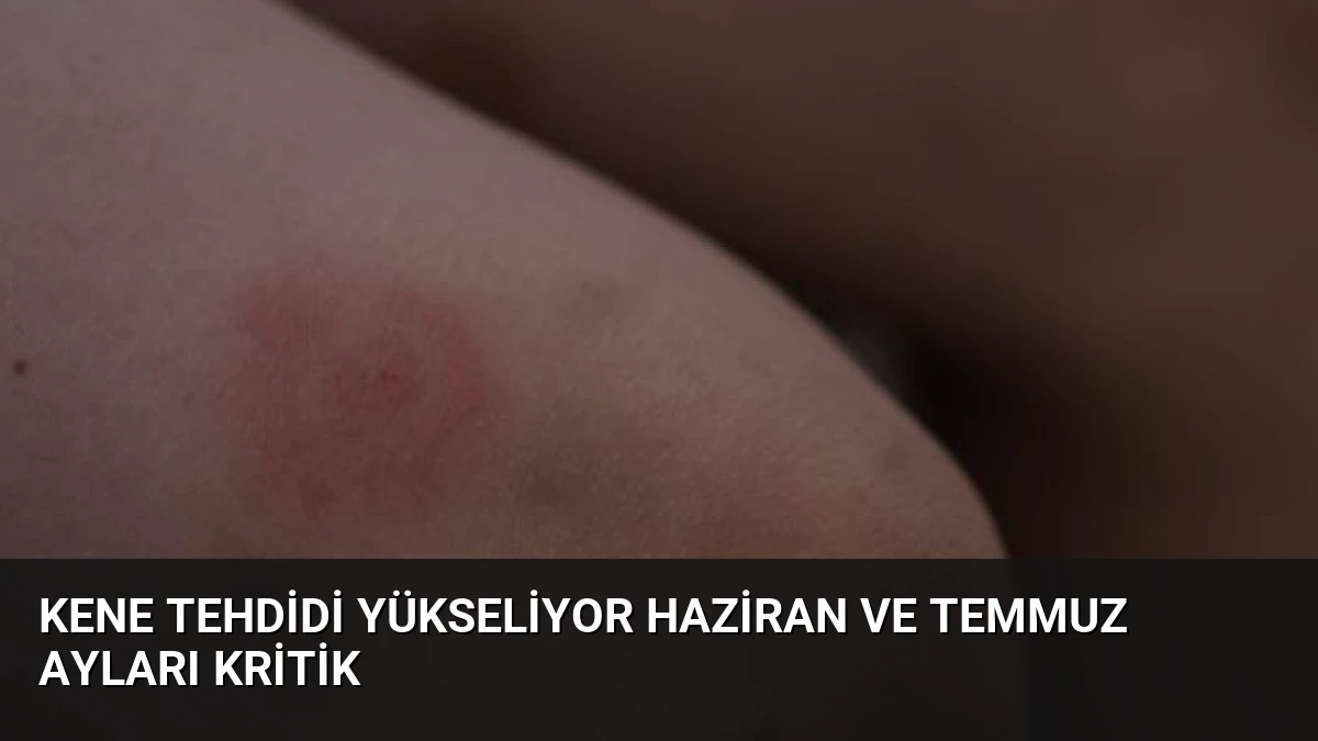 Kene Tehdidi Yükseliyor Haziran ve Temmuz Ayları Kritik